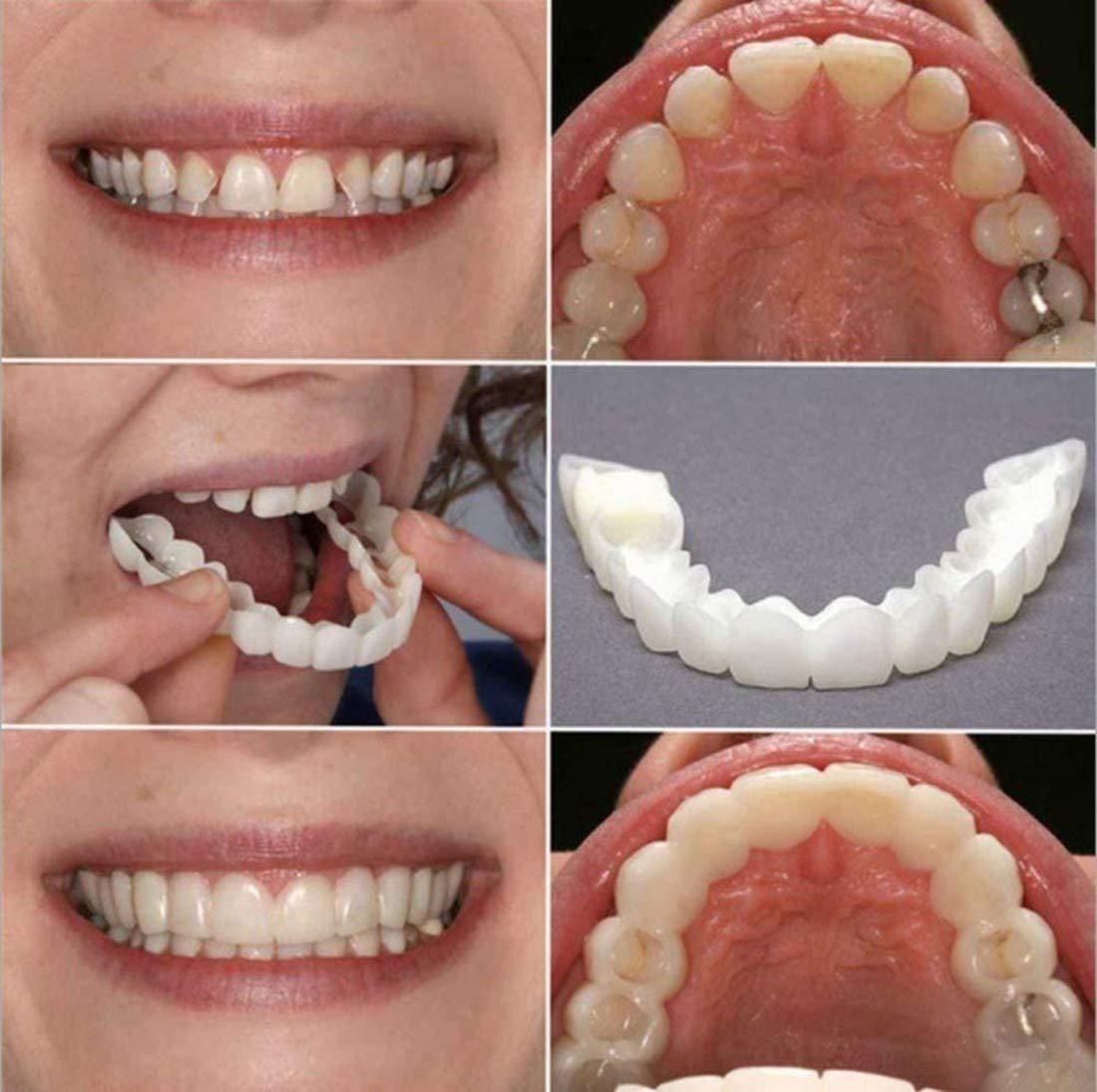 Instant Snap-On Smile Veneers – Natural Looking Fake Teeth Cover Sale priceRs. 499
