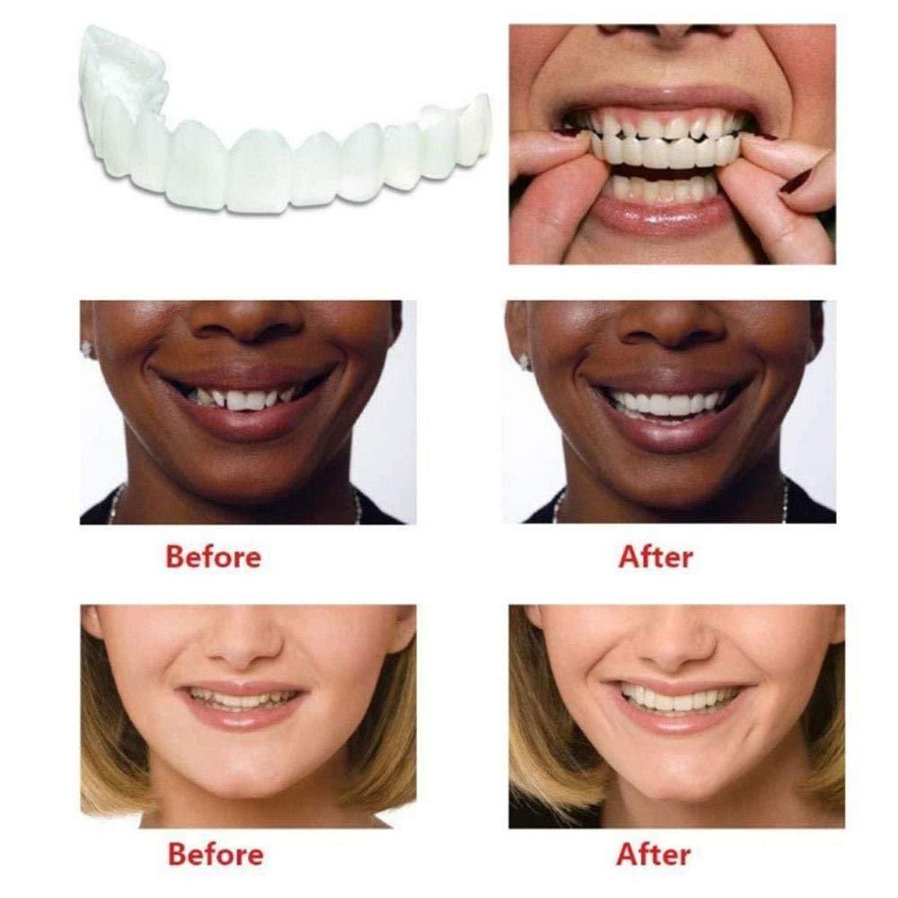 Instant Snap-On Smile Veneers – Natural Looking Fake Teeth Cover Sale priceRs. 499